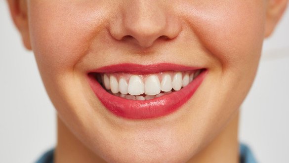 Teeth After Orthodontics